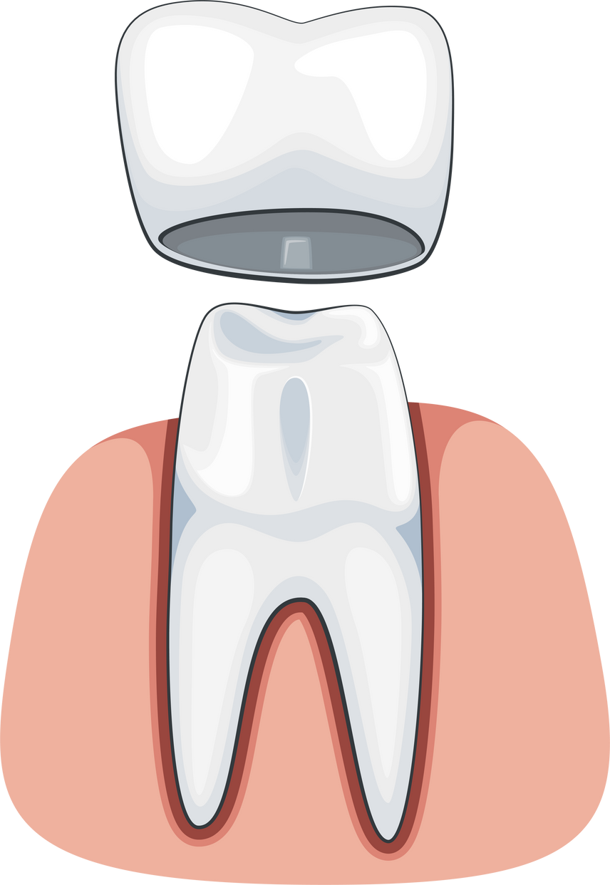 Tooth Crown Illustration, Dental Supplies