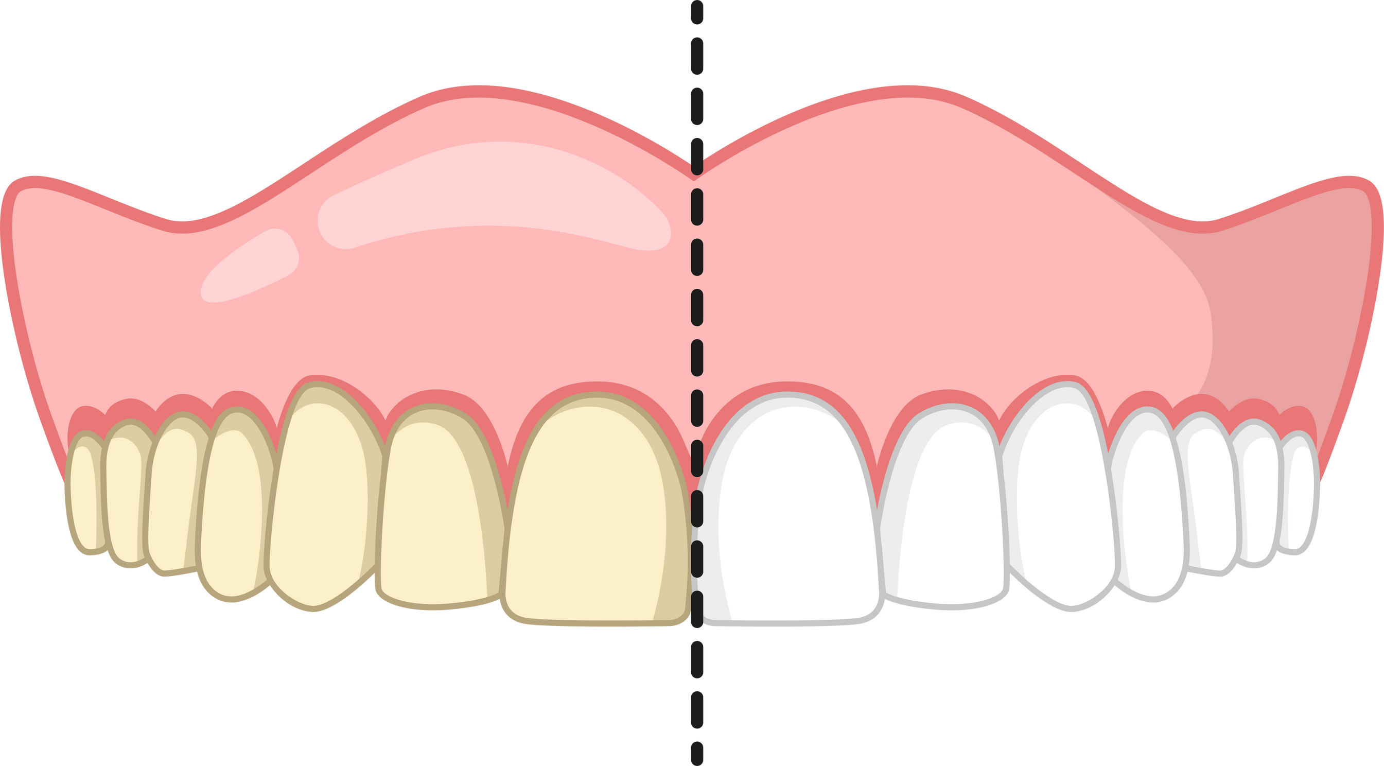 Teeth Whitening Illustration